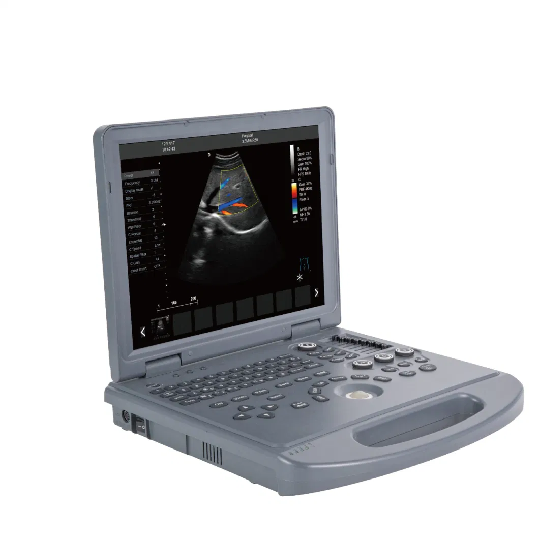 Medical Equipment Portable/Robust Cardiovascular 4D Capability Ultrasound Scanner System with CE ISO