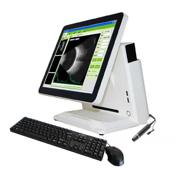 CAS-2000d China Ophthalmic Equipment Ophthalmology Ultrasound Ab Scanner a B Scan with Built-in Computer