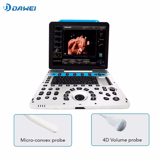 Chison Ebit50 4D 5D Sistema di imaging dianostico digitale portatile Color Doppler Umano Ginecologia ad ultrasuoni, Macchina per ecografia cardiovascolare